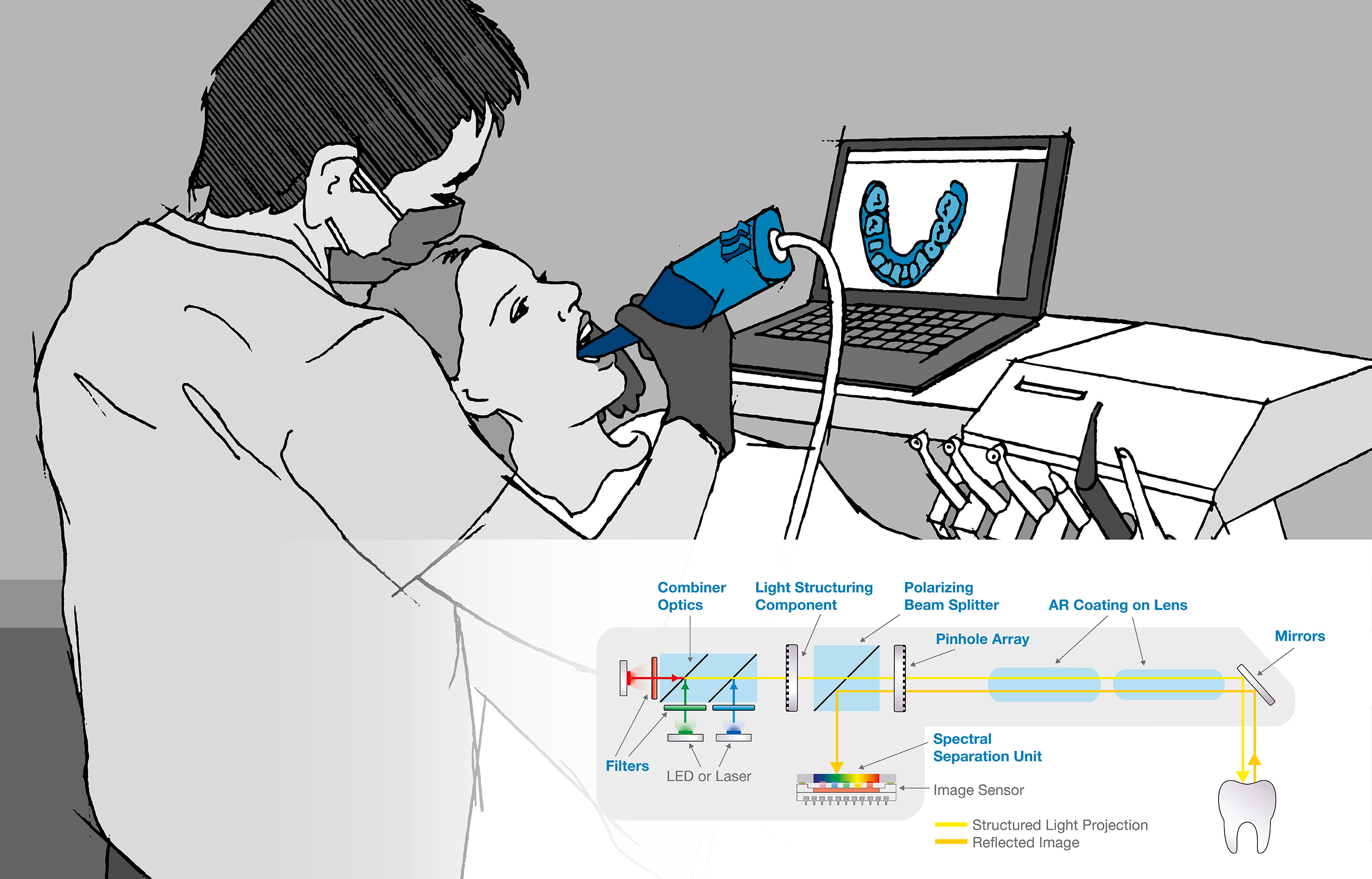 Materion Balzers Optics IntraOral Scanner